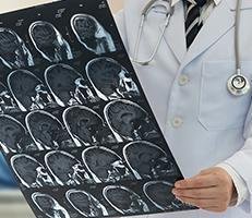 Brain Tumors surgery and treatments California neurosurgical Institute